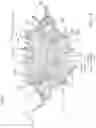 Fig. 90 - Prosthetic heart valve