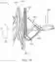 Fig. 95 - Prosthetic heart valve