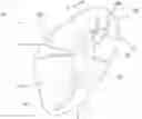 Fig. 01 - METHOD FOR MANUFACTURING A LOW-PROFILE INTERCRANIAL DEVICE AND THE LOW-PROFILE INTERCRANIAL DEVICE MANUFACTURED THEREBY