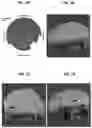 Fig. 02 - Microchannels in subchondral bone and membranes comprising same for the treatment of osteoarthritis