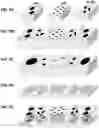 Fig. 09 - Microchannels in subchondral bone and membranes comprising same for the treatment of osteoarthritis