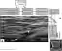 Fig. 01 - SURGICAL TREATMENT FOR GLAUCOMA