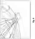 Fig. 09 - SURGICAL TREATMENT FOR GLAUCOMA