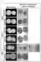 Fig. 07 - PLURIPOTENT STEM CELL-DERIVED PLATE-SHAPED CARTILAGE AND METHOD FOR PRODUCING THE SAME