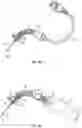 Fig. 09 - Pediatric catheter system and related devices and methods