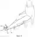 Fig. 06 - ANKLE REHABILITATION DEVICE AND METHOD FOR THE USE THEREOF