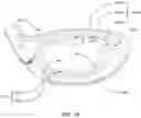 Fig. 10 - Golf club head with improved variable thickness striking face