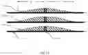 Fig. 11 - Golf club head with improved variable thickness striking face