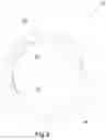 Fig. 03 - Ball Game Apparatus and Method of Play