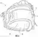 Fig. 07 - Ball glove having ball spin reduction webbing
