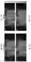 Fig. 19 - USING NEURAL NETWORKS TO ESTIMATE MOTION VECTORS FOR MOTION CORRECTED PET IMAGE RECONSTRUCTION