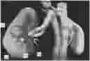 Fig. 01 - Multi-modal visualization in computer-assisted tele-operated surgery