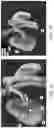 Fig. 07 - Multi-modal visualization in computer-assisted tele-operated surgery