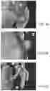 Fig. 08 - Multi-modal visualization in computer-assisted tele-operated surgery