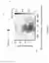 Fig. 07 - METHODS AND SYSTEMS FOR DETERMINING HEARING THRESHOLDS