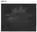 Fig. 10 - Macroscopically alignable, injectable, soft hydrogel composition