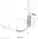 Fig. 12 - Device for gripping and securing an intubation bougie