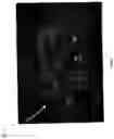 Fig. 08 - Assessment and improvement of treatment using imaging of physiological responses to radiation therapy