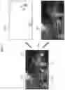 Fig. 04 - Method and apparatus for game streaming