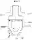 Fig. 06 - Device for enhancing rigidity of vehicle body