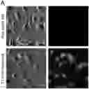 Fig. 01 - COMPOSITIONS AND METHODS FOR TREATING CD40-MEDIATED DISEASES