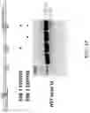 Fig. 46 - METHODS FOR EXON SKIPPING AND GENE KNOCKOUT USING BASE EDITORS