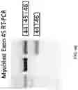 Fig. 49 - METHODS FOR EXON SKIPPING AND GENE KNOCKOUT USING BASE EDITORS