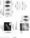 Fig. 17 - USE OF DROPLET SINGLE CELL EPIGENOME PROFILING FOR PATIENT STRATIFICATION