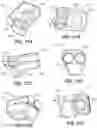 Fig. 40 - HDD reamer having removable cutting teeth