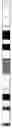 Fig. 01 - Chromosome recognition method based on deep learning