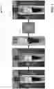 Fig. 04 - Method and system for real-time and offline de-identification of facial regions from regular and occluded color video streams obtained during diagnostic medical procedures