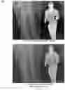 Fig. 08 - Median based frequency separation local area contrast enhancement