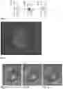Fig. 02 - Characterization and classification of spot welds by ultrasonic diagnostic techniques