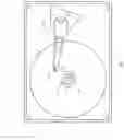 Fig. 02 - Head gimbal assembly with damping material