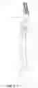 Fig. 06 - Soldier-mounted antenna