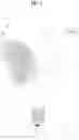 Fig. 02 - Diffuser and hair dryer having a diffuser