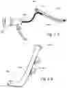 Fig. 08 - Methods and apparatus for treating disorders of the ear nose and throat