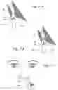 Fig. 13 - Methods and apparatus for treating disorders of the ear nose and throat