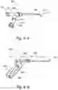Fig. 14 - Methods and apparatus for treating disorders of the ear nose and throat