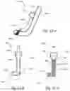 Fig. 17 - Methods and apparatus for treating disorders of the ear nose and throat