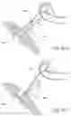 Fig. 18 - Methods and apparatus for treating disorders of the ear nose and throat
