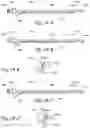 Fig. 19 - Methods and apparatus for treating disorders of the ear nose and throat