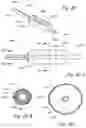 Fig. 24 - Methods and apparatus for treating disorders of the ear nose and throat