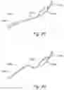 Fig. 25 - Methods and apparatus for treating disorders of the ear nose and throat