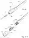Fig. 27 - Methods and apparatus for treating disorders of the ear nose and throat