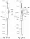 Fig. 30 - Methods and apparatus for treating disorders of the ear nose and throat