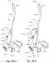 Fig. 34 - Methods and apparatus for treating disorders of the ear nose and throat