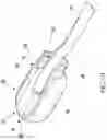 Fig. 02 - METHODS AND DEVICES FOR IN SITU FORMED NERVE CAP WITH RAPID RELEASE