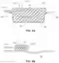 Fig. 09 - METHODS AND DEVICES FOR IN SITU FORMED NERVE CAP WITH RAPID RELEASE