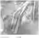 Fig. 28 - METHODS AND DEVICES FOR IN SITU FORMED NERVE CAP WITH RAPID RELEASE